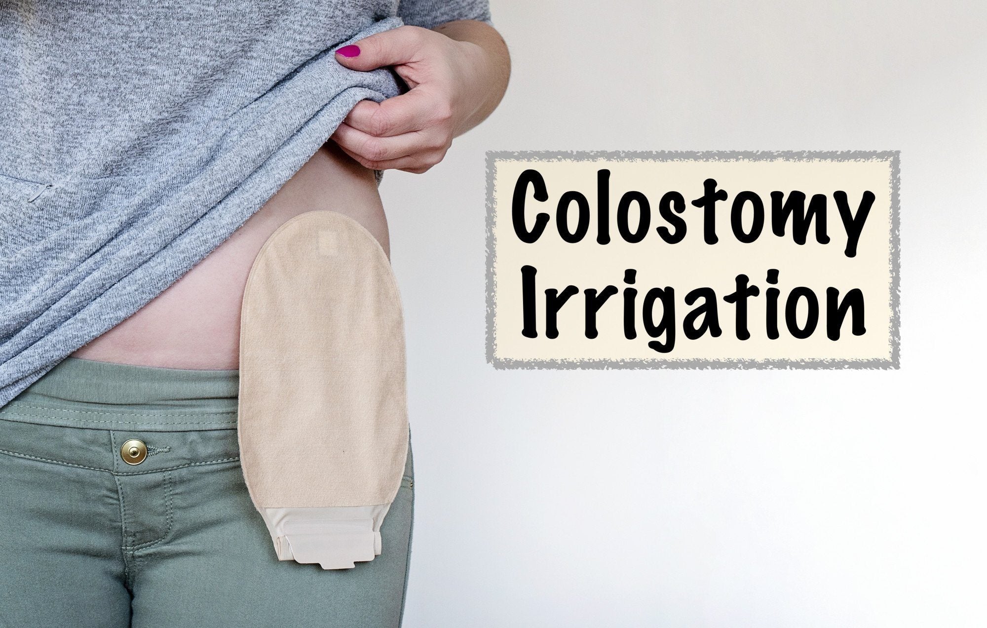 Will I Need a Colostomy Bag With Bowel Cancer Treatment?